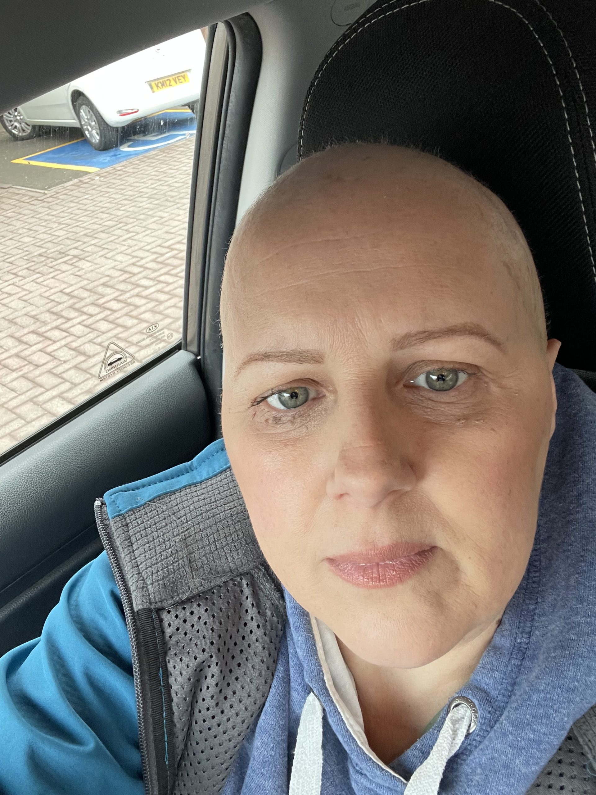 Heather Dunne underwent chemo and a mastectomy